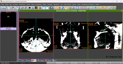 DICOM Viewer Pro