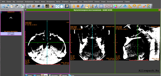 DICOM Viewer Pro